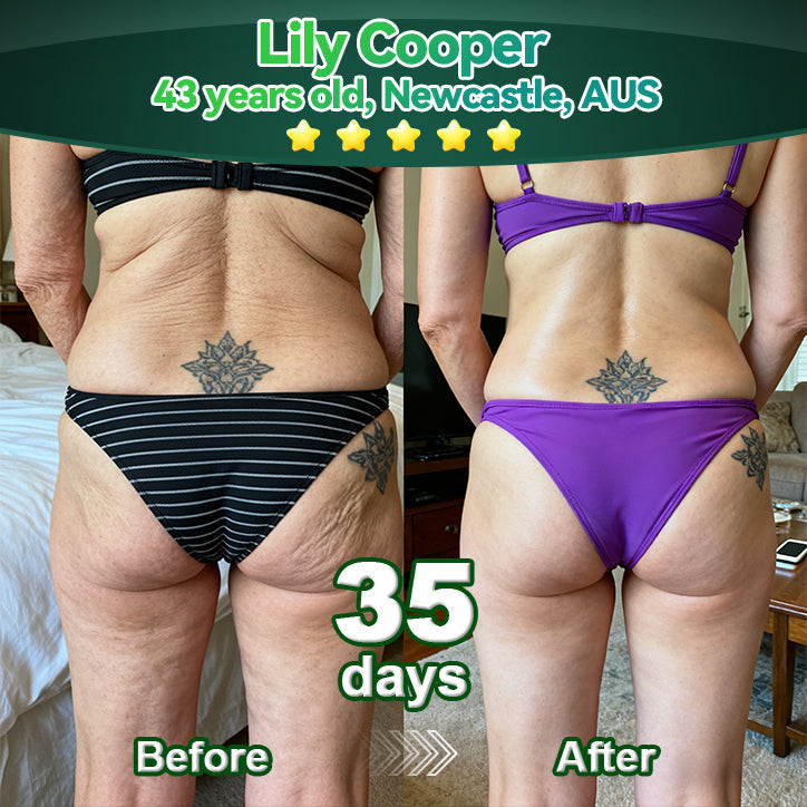 𝐎𝐟𝐟𝐢𝐜𝐢𝐚𝗜𝗜𝐲 𝐀𝐮𝐭𝐡𝐨𝐫𝐢𝐬𝐞𝐝 𝐄𝐱𝐜𝐥𝐮𝐬𝐢𝐯𝐞 𝐄𝐝𝐢𝐭𝐢𝐨𝐧 | 𝐋𝗼𝐭𝐦𝒂𝐲® 𝐒𝐭𝒆𝐦 𝐂𝒆𝗜𝗜 & 𝐂𝗼𝗜𝗜𝐚𝐠𝒆𝐧 𝐏𝒆𝐩𝐭𝐢𝐝𝒆 𝐎𝐫𝐚𝗜 𝐃𝐫𝗼𝐩𝐬 👩‍⚕️(Lift & Firm Sagging Skin & Reduce Wrinkle Formation)👍