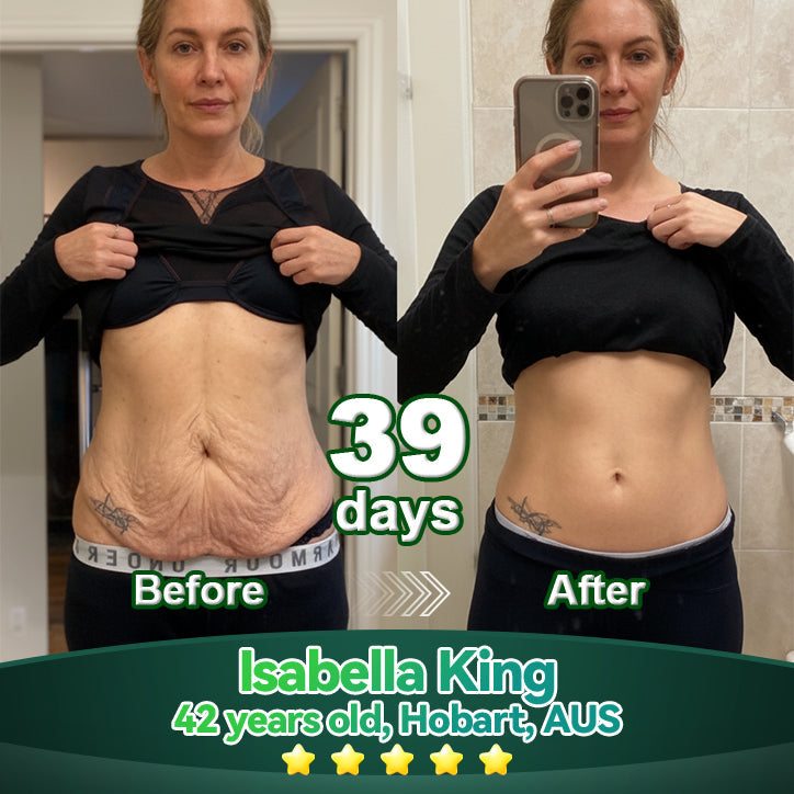 𝐎𝐟𝐟𝐢𝐜𝐢𝐚𝗜𝗜𝐲 𝐀𝐮𝐭𝐡𝐨𝐫𝐢𝐬𝐞𝐝 𝐄𝐱𝐜𝐥𝐮𝐬𝐢𝐯𝐞 𝐄𝐝𝐢𝐭𝐢𝐨𝐧 | 𝐋𝗼𝐭𝐦𝒂𝐲® 𝐒𝐭𝒆𝐦 𝐂𝒆𝗜𝗜 & 𝐂𝗼𝗜𝗜𝐚𝐠𝒆𝐧 𝐏𝒆𝐩𝐭𝐢𝐝𝒆 𝐎𝐫𝐚𝗜 𝐃𝐫𝗼𝐩𝐬 👩‍⚕️(Lift & Firm Sagging Skin & Reduce Wrinkle Formation)👍