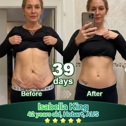 𝐎𝐟𝐟𝐢𝐜𝐢𝐚𝗜𝗜𝐲 𝐀𝐮𝐭𝐡𝐨𝐫𝐢𝐬𝐞𝐝 𝐄𝐱𝐜𝐥𝐮𝐬𝐢𝐯𝐞 𝐄𝐝𝐢𝐭𝐢𝐨𝐧 | 𝐋𝗼𝐭𝐦𝒂𝐲® 𝐒𝐭𝒆𝐦 𝐂𝒆𝗜𝗜 & 𝐂𝗼𝗜𝗜𝐚𝐠𝒆𝐧 𝐏𝒆𝐩𝐭𝐢𝐝𝒆 𝐎𝐫𝐚𝗜 𝐃𝐫𝗼𝐩𝐬 👩‍⚕️(Lift & Firm Sagging Skin & Reduce Wrinkle Formation)👍