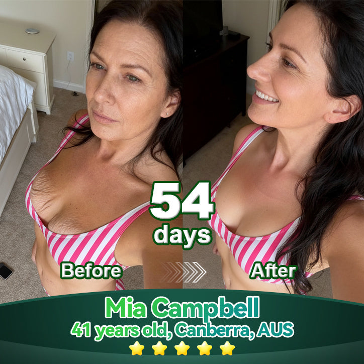 𝐎𝐟𝐟𝐢𝐜𝐢𝐚𝗜𝗜𝐲 𝐀𝐮𝐭𝐡𝐨𝐫𝐢𝐬𝐞𝐝 𝐄𝐱𝐜𝐥𝐮𝐬𝐢𝐯𝐞 𝐄𝐝𝐢𝐭𝐢𝐨𝐧 | 𝐋𝗼𝐭𝐦𝒂𝐲® 𝐒𝐭𝒆𝐦 𝐂𝒆𝗜𝗜 & 𝐂𝗼𝗜𝗜𝐚𝐠𝒆𝐧 𝐏𝒆𝐩𝐭𝐢𝐝𝒆 𝐎𝐫𝐚𝗜 𝐃𝐫𝗼𝐩𝐬 👩‍⚕️(Lift & Firm Sagging Skin & Reduce Wrinkle Formation)👍