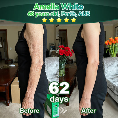 𝐎𝐟𝐟𝐢𝐜𝐢𝐚𝗜𝗜𝐲 𝐀𝐮𝐭𝐡𝐨𝐫𝐢𝐬𝐞𝐝 𝐄𝐱𝐜𝐥𝐮𝐬𝐢𝐯𝐞 𝐄𝐝𝐢𝐭𝐢𝐨𝐧 | 𝐋𝗼𝐭𝐦𝒂𝐲® 𝐒𝐭𝒆𝐦 𝐂𝒆𝗜𝗜 & 𝐂𝗼𝗜𝗜𝐚𝐠𝒆𝐧 𝐏𝒆𝐩𝐭𝐢𝐝𝒆 𝐎𝐫𝐚𝗜 𝐃𝐫𝗼𝐩𝐬 👩‍⚕️(Lift & Firm Sagging Skin & Reduce Wrinkle Formation)👍